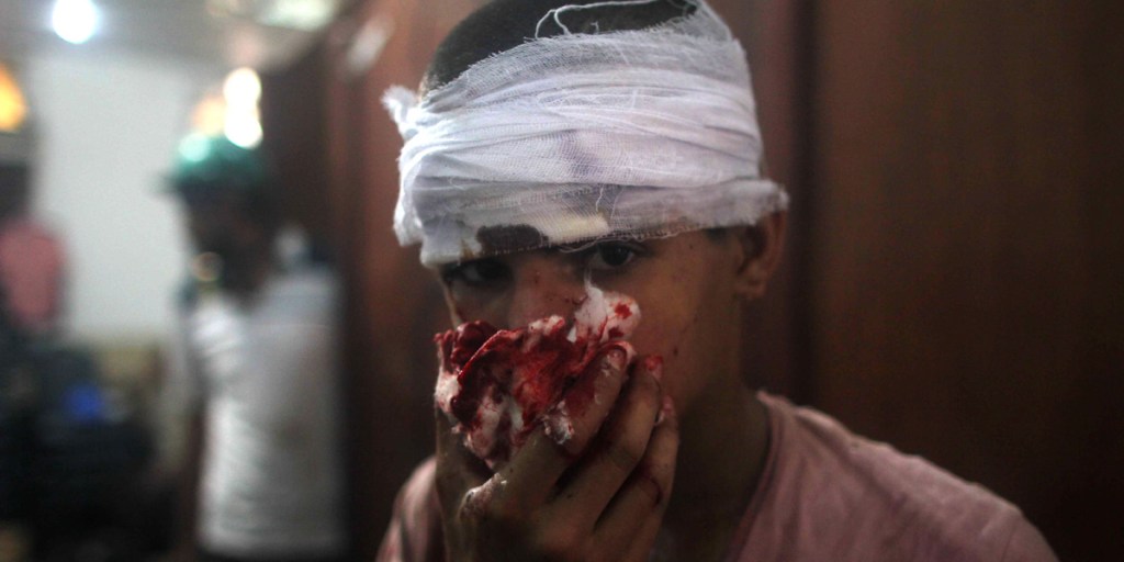 A boy injured in this week's Egyptian bloodshed.