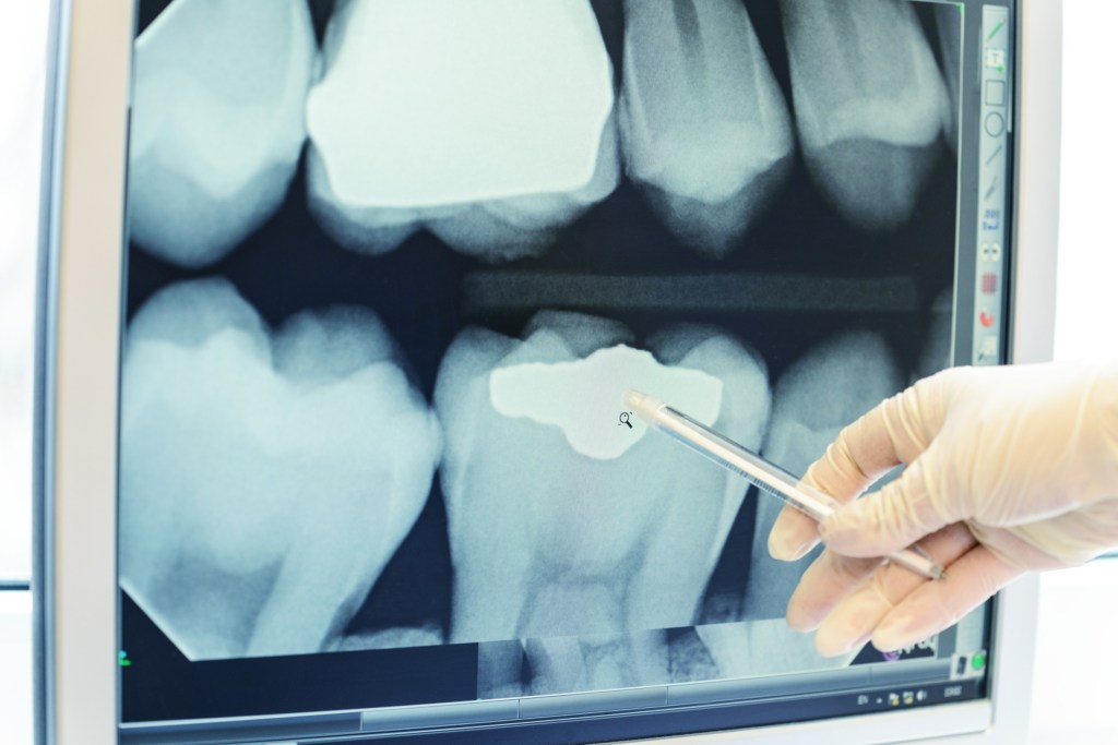 Thumbnail for Bringing dental x-ray technology into the fast lane