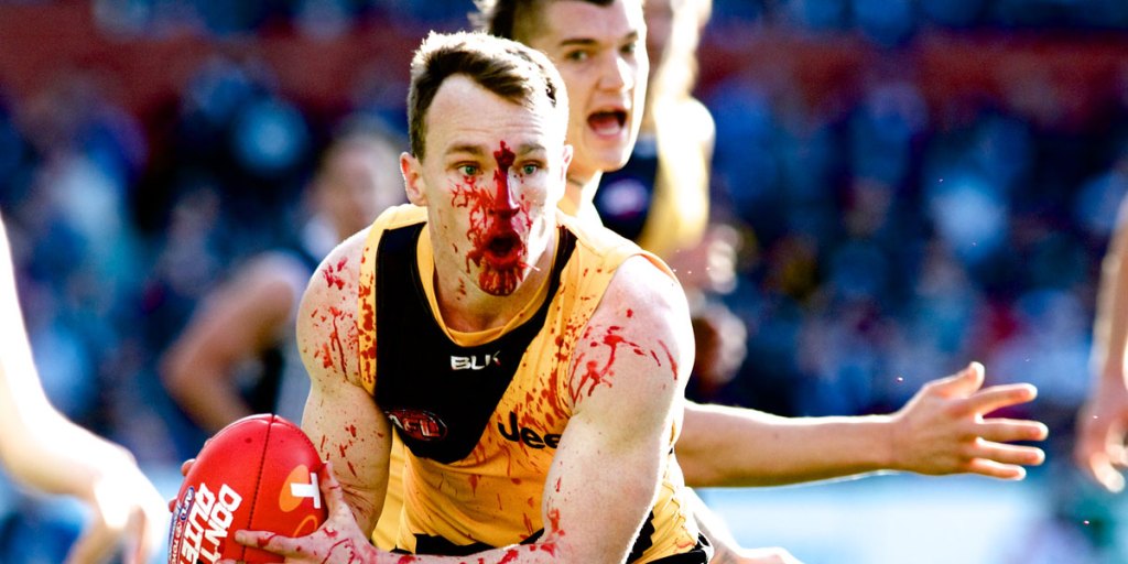 Award-winner: Bloodbath at Adelaide Oval, by Michael Errey