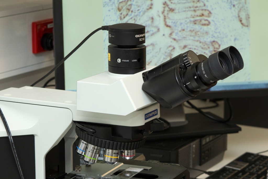 The lengthy process of colonoscopies and microscopic analysis are being undertaken by some people who don't need them them, and not by others who do. 
