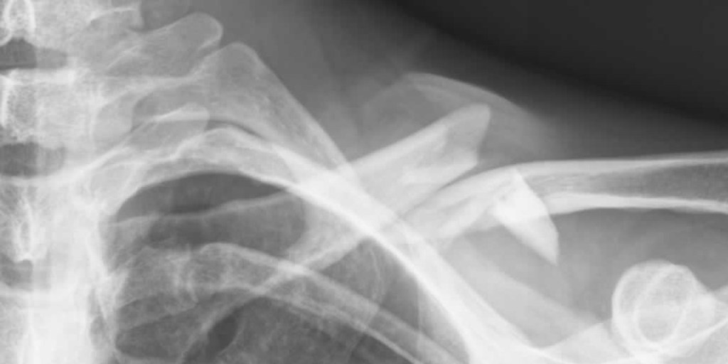 Thumbnail for Radiologist shortage a risk: doctors’ union