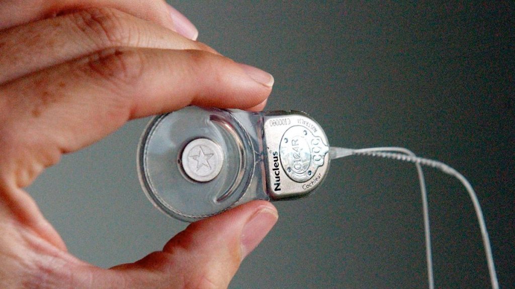 Thumbnail for Payouts for families over SA cochlear implant bungle
