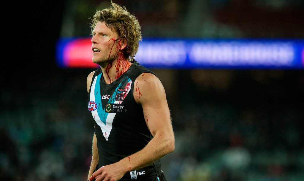 Despite copping a telling blow to the head, Brad Ebert was a rare shining light for Port. Photo: Michael Errey, InDaily.