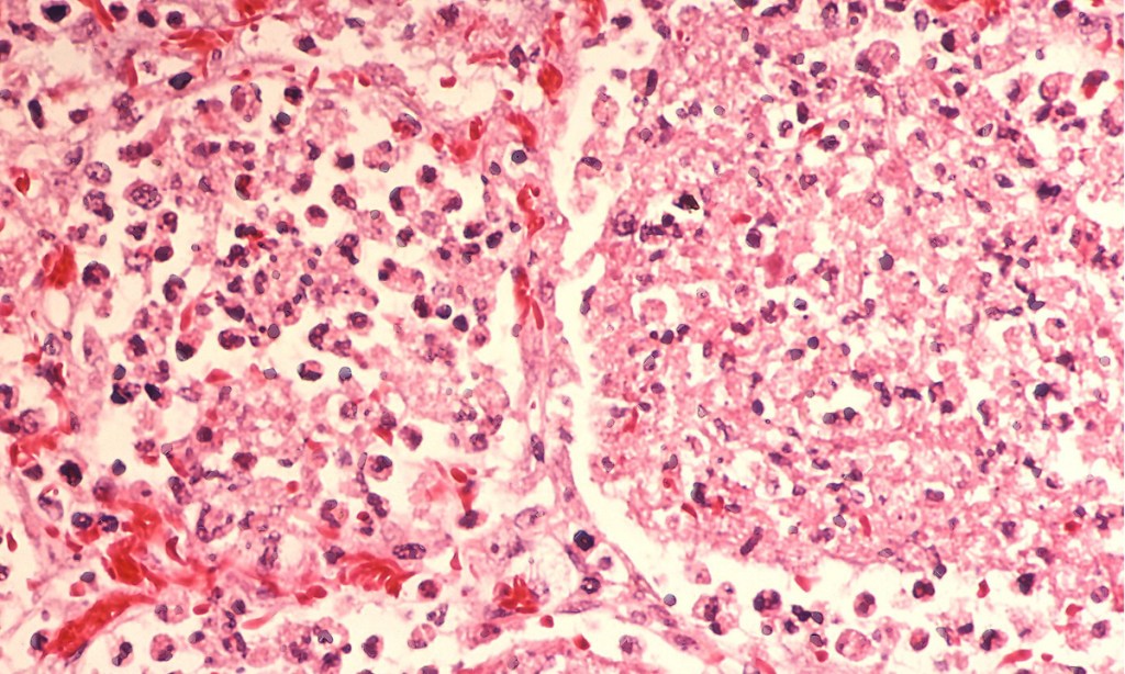 Thumbnail for Call to increase Legionella controls at home and hospitals