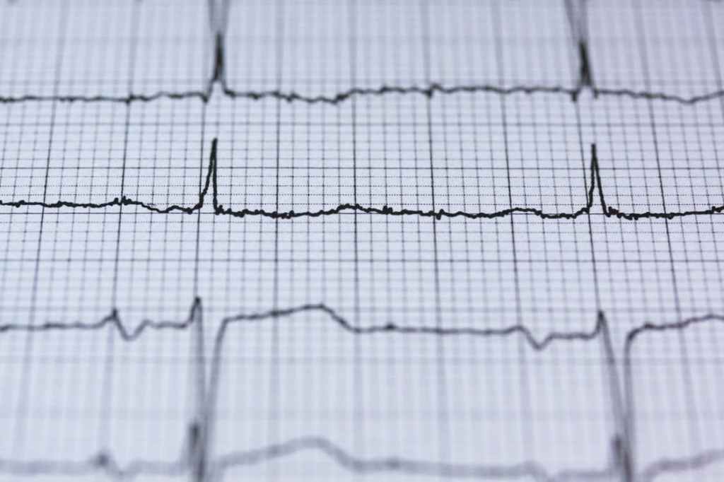 Thumbnail for Early menopause linked to heart disease risk