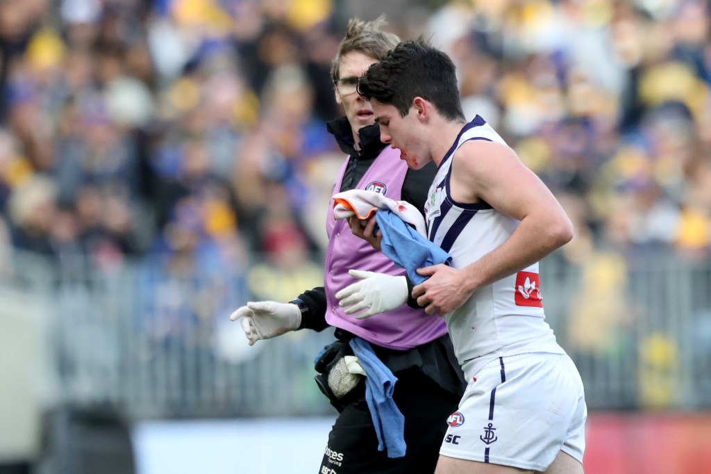 Thumbnail for Young Docker out for season after unprovoked hit