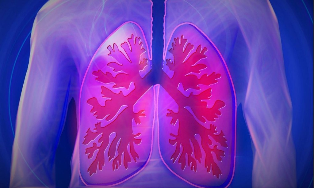 Thumbnail for Clues to earlier diagnosis of deadly lung disease