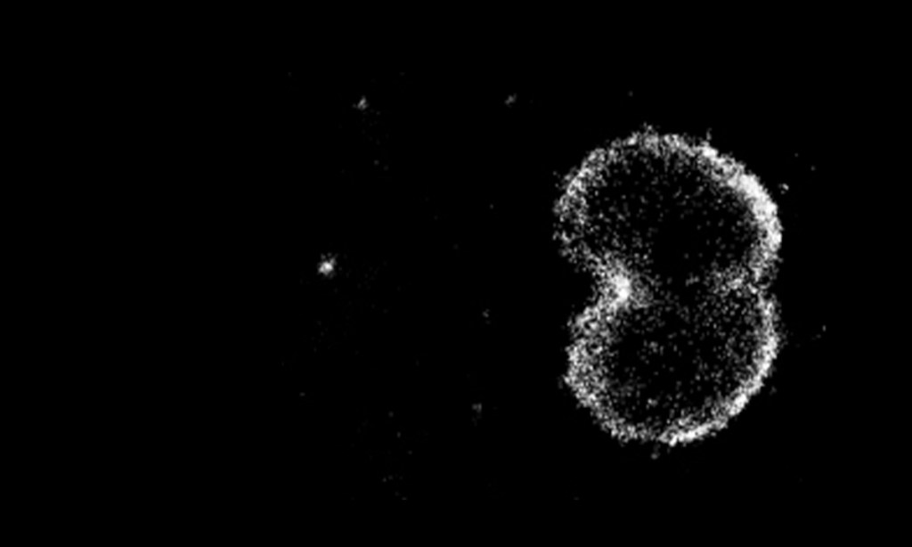  Gonorrhoea-causing bacteria and their vesicles interacting with immune cells, captured by a microscope. Australian scientists have Photo: AAP/ Monash University Biomedicine Discovery Institute