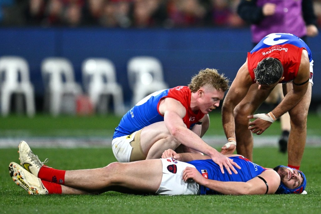 Thumbnail for Concussion forces Demons’ Angus Brayshaw out of game