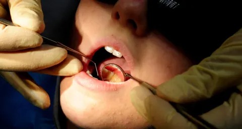 Thumbnail for Greens to push for Medicare dental treatment