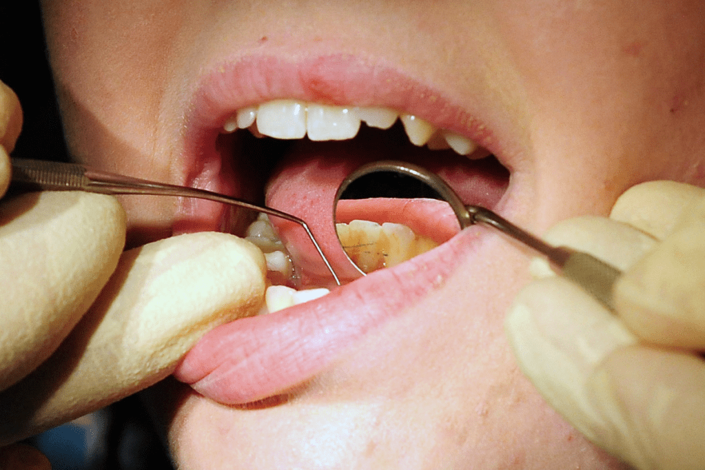 Thumbnail for Dentist visits delayed as cost of living bites
